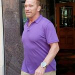Arnold Schwarzenegger plastic surgery (6)