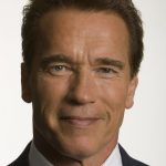 Arnold Schwarzenegger plastic surgery (7)