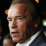 Arnold Schwarzenegger plastic surgery (9)