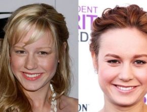 Brie Larson before and after plastic surgery (16)