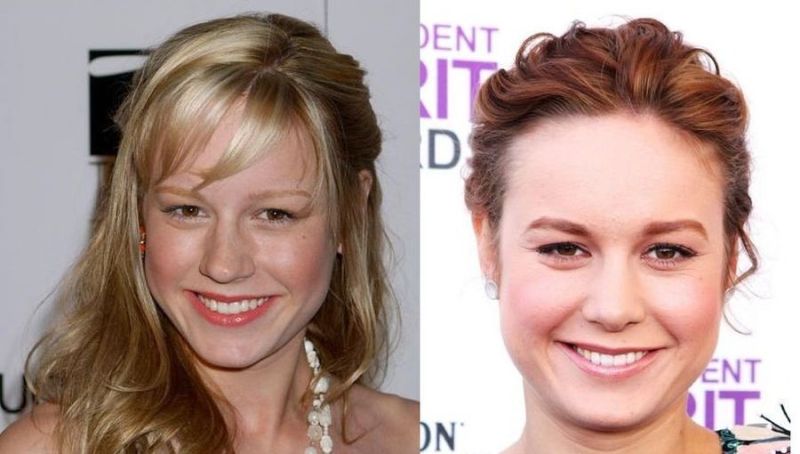 Brie Larson before and after plastic surgery (16) .