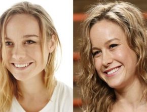 Brie Larson before and after plastic surgery