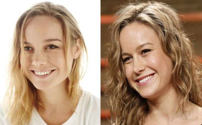 Brie Larson before and after plastic surgery