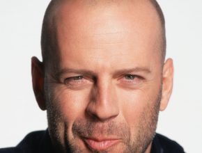 Bruce Willis plastic surgery (03)