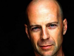 Bruce Willis plastic surgery (1)