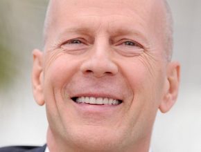 Bruce Willis plastic surgery (15)