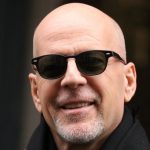 Bruce Willis plastic surgery (2)