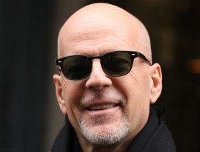 Bruce Willis plastic surgery (2)