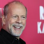 Bruce Willis plastic surgery (20)