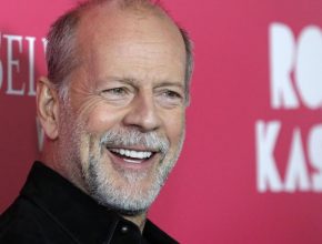 Bruce Willis plastic surgery (20)