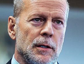 Bruce Willis plastic surgery