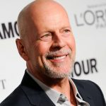 Bruce Willis plastic surgery (3)