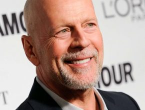 Bruce Willis plastic surgery (3)