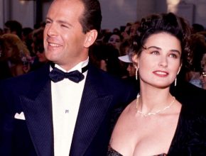 Bruce Willis plastic surgery (38) with Demi Moore