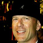 Bruce Willis plastic surgery (39)