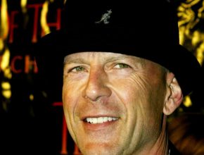 Bruce Willis plastic surgery (39)