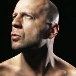 Bruce Willis plastic surgery (8)