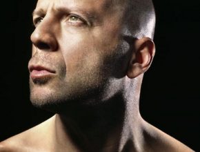 Bruce Willis plastic surgery (8)