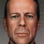Bruce Willis plastic surgery (9)