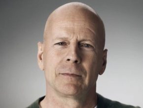 Bruce Willis plastic surgery