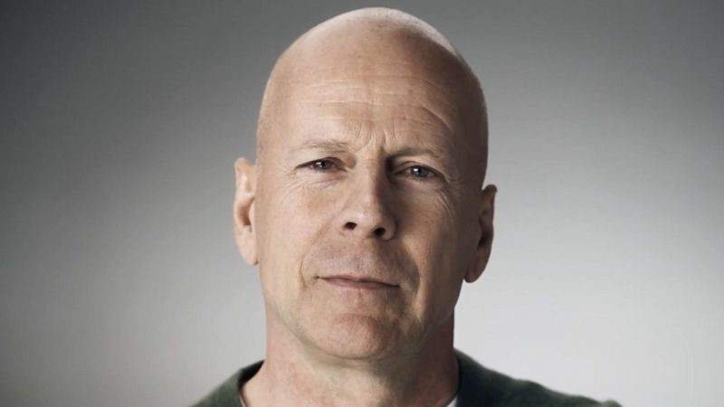 Bruce Willis plastic surgery