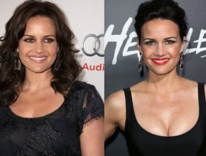 Carla Gugino before and after plastic surgery