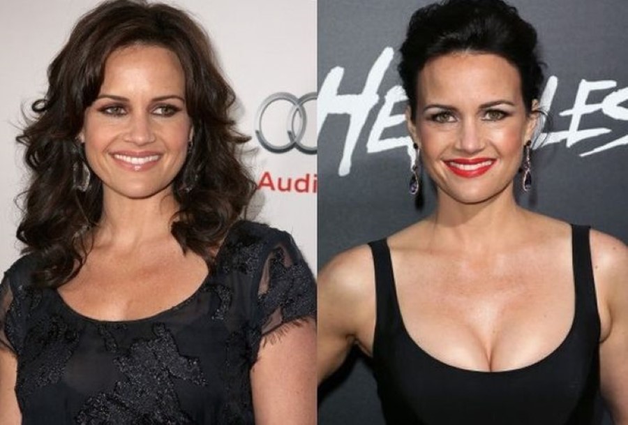 Carla Gugino before and after plastic surgery