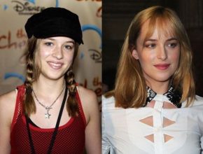Dakota Johnson before and after plastic surgery