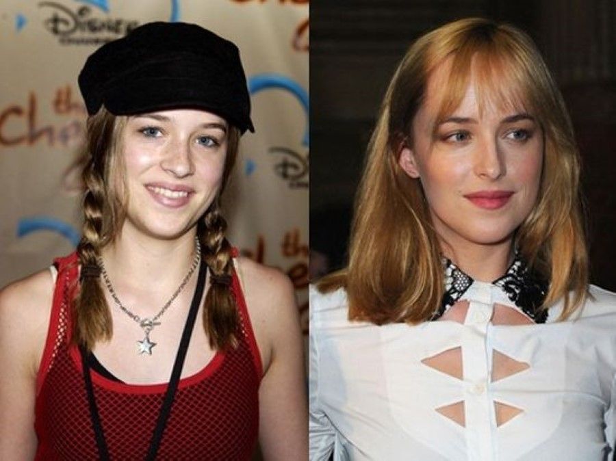 Dakota Johnson before and after plastic surgery