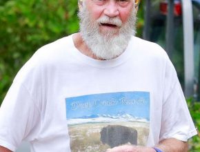 David Letterman plastic surgery (27)