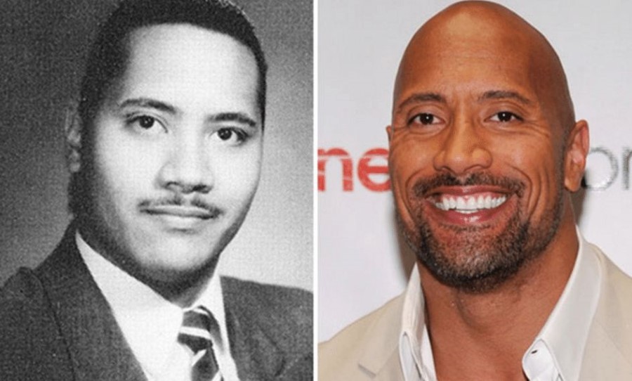 Dwayne Johnson before and after plastic surgery