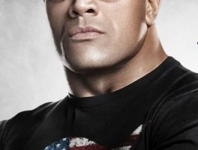 Dwayne Johnson plastic surgery (19)