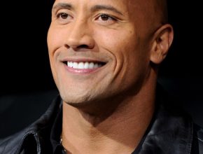 Dwayne Johnson plastic surgery (6)