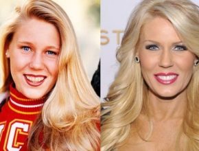 Gretchen Rossi before and after plastic surgery