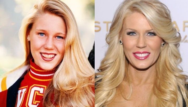 Gretchen Rossi before and after plastic surgery