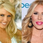 Gretchen Rossi before and after plastic surgery (11)