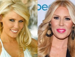 Gretchen Rossi before and after plastic surgery (11)