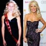 Gretchen Rossi before and after plastic surgery (20)