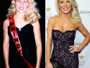 Gretchen Rossi before and after plastic surgery (20)