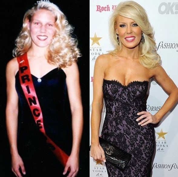 Gretchen Rossi before and after plastic surgery (20) - Celebrity plastic surgery online