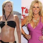 Gretchen Rossi before and after plastic surgery (27)