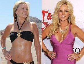 Gretchen Rossi before and after plastic surgery (27)
