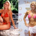 Gretchen Rossi plastic surgery (22)