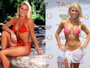 Gretchen Rossi plastic surgery (22)