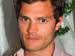 Jamie Dornan plastic surgery (9)