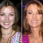 Jane Seymour before and after plastic surgery (1)