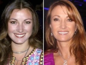 Jane Seymour before and after plastic surgery (1)