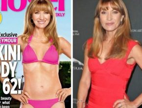 Jane Seymour before and after plastic surgery