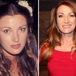 Jane Seymour before and after plastic surgery (2)