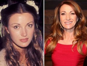 Jane Seymour before and after plastic surgery (2)